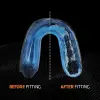 Shock Doctor Gel Max mouthguard